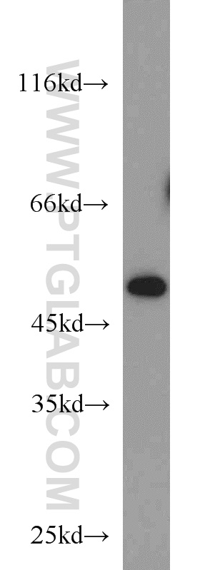 10972-1-AP;Jurkat cells