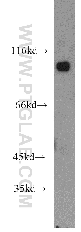 13974-1-AP;mouse testis tissue