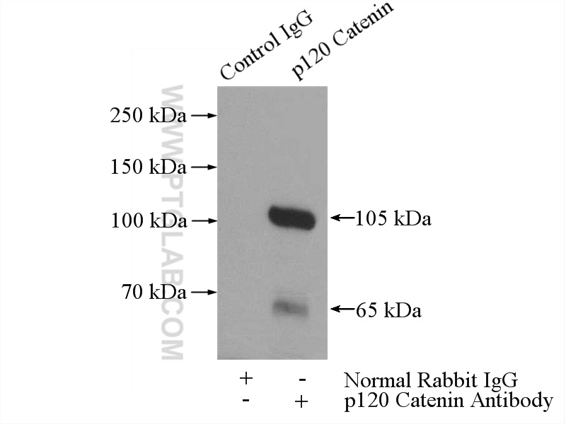 12180-1-AP;mouse brain tissue