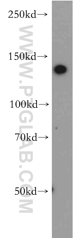 20672-1-AP;HeLa cell