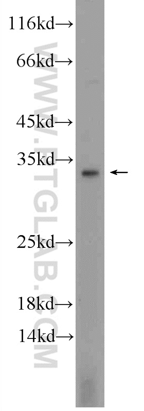 23840-1-AP;MCF-7 cells