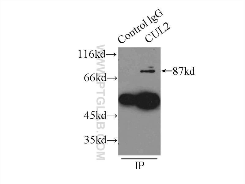 10981-2-AP;HeLa cells