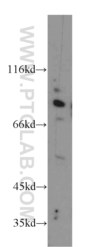 10981-2-AP;HeLa cells