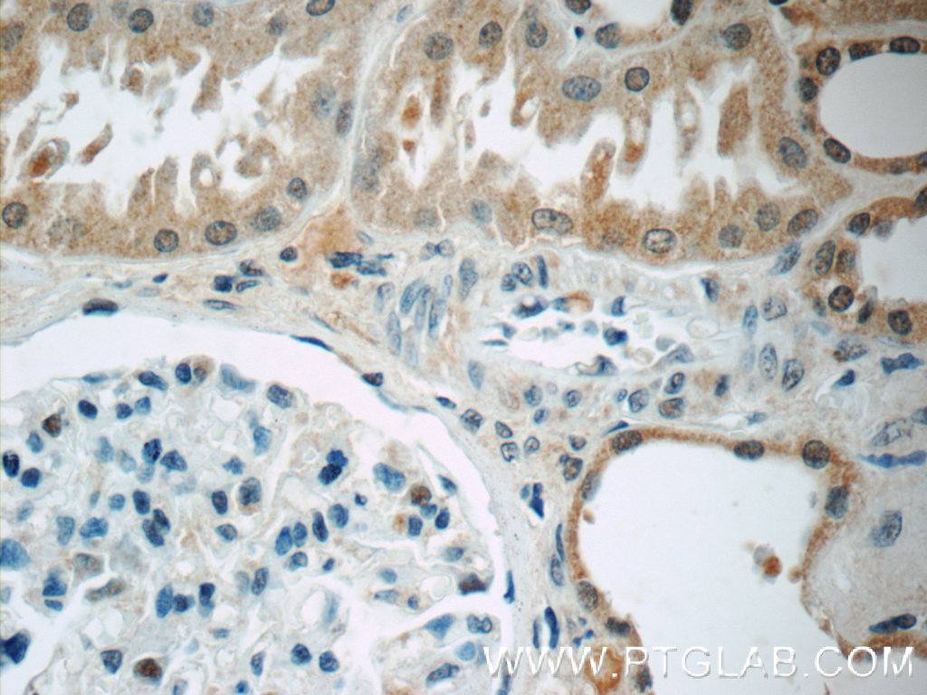 24872-1-AP;human kidney tissue