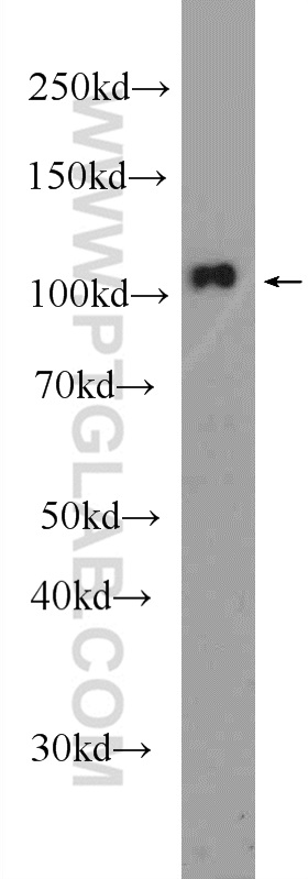 24872-1-AP;HeLa cells