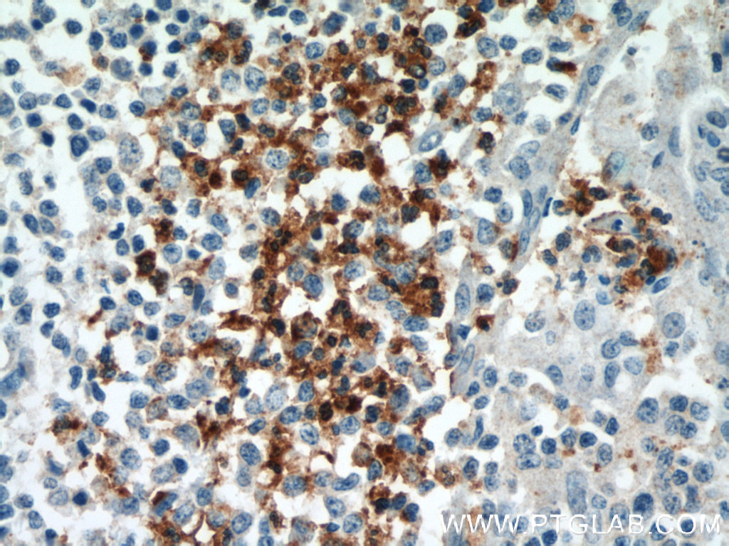 13885-1-AP;human tonsillitis tissue