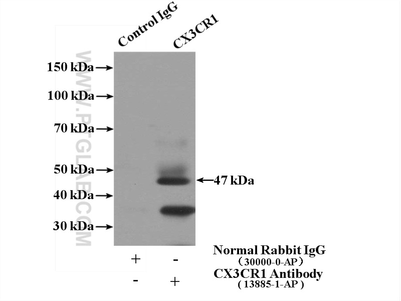 13885-1-AP;SH-SY5Y cells