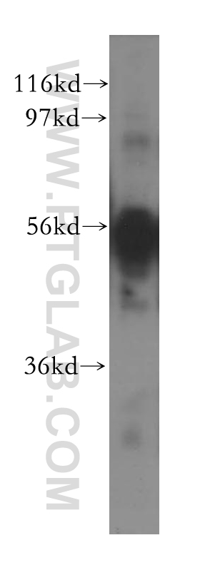 11777-1-AP;BxPC-3 cell