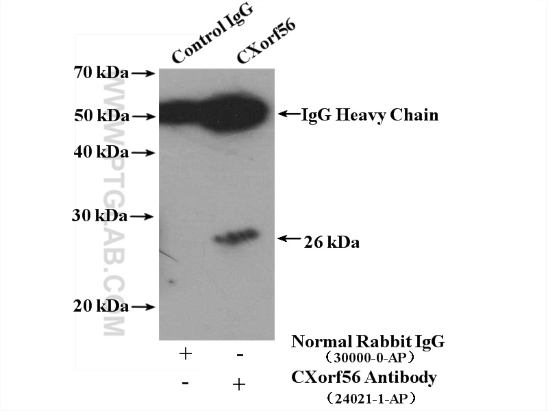 24021-1-AP;mouse kidney tissue