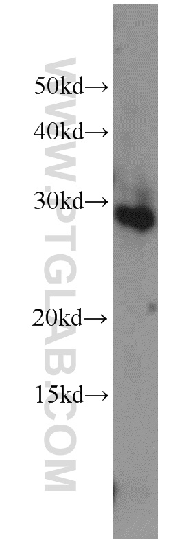 24021-1-AP;HeLa cells