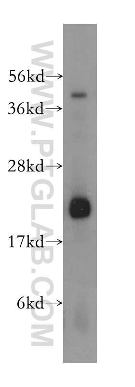 15469-1-AP;mouse lung tissue