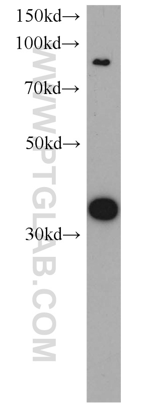 10242-1-AP;human brain tissue