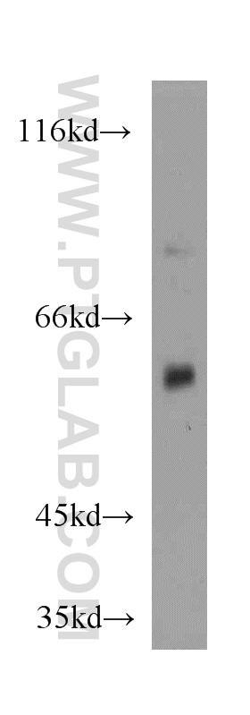 11688-1-AP;mouse kidney tissue