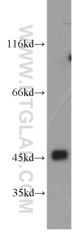 16687-1-AP;human brain tissue