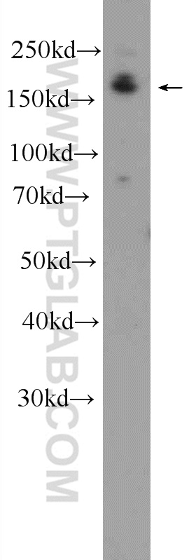 25136-1-AP;A549 cells