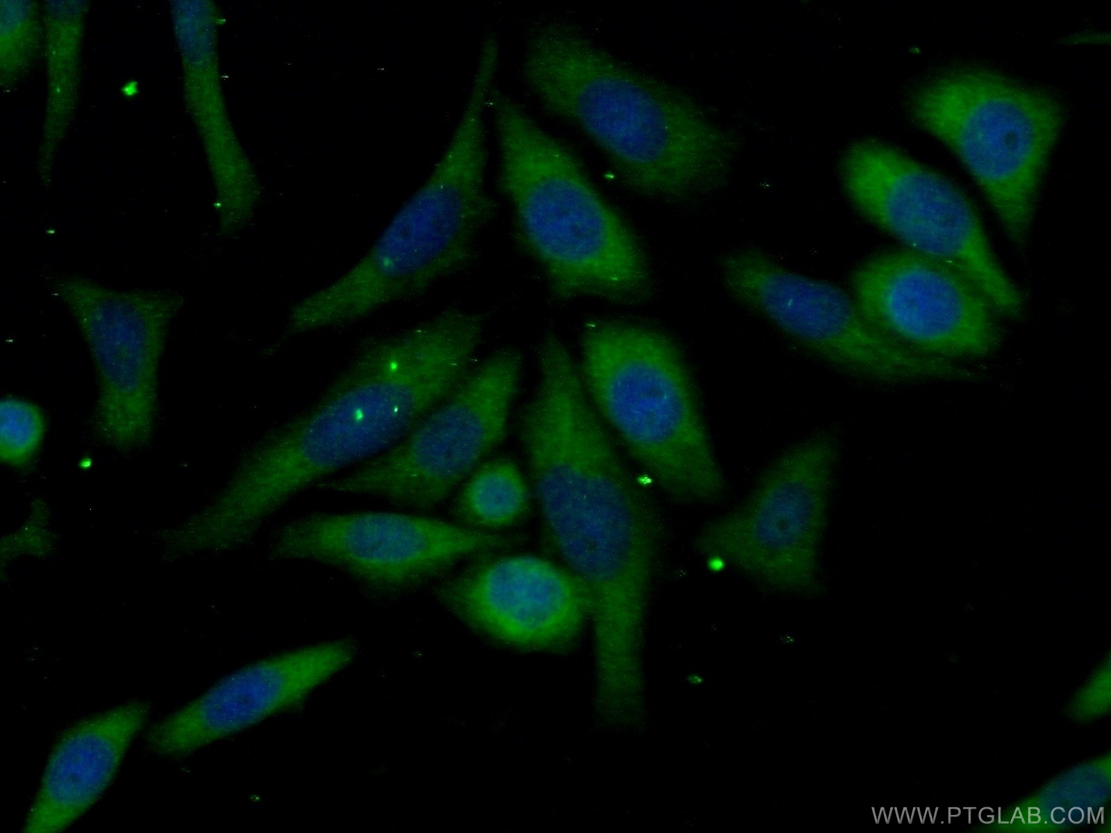 19540-1-AP;HeLa cells