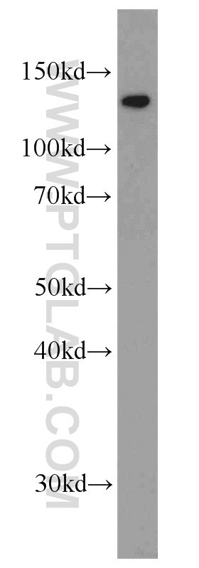 22638-1-AP;mouse brain tissue