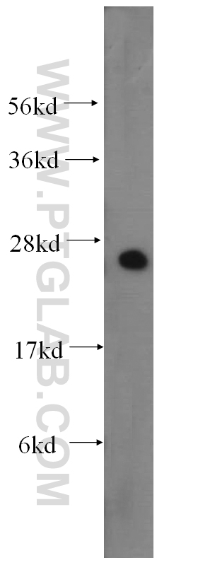 15188-1-AP;human testis tissue