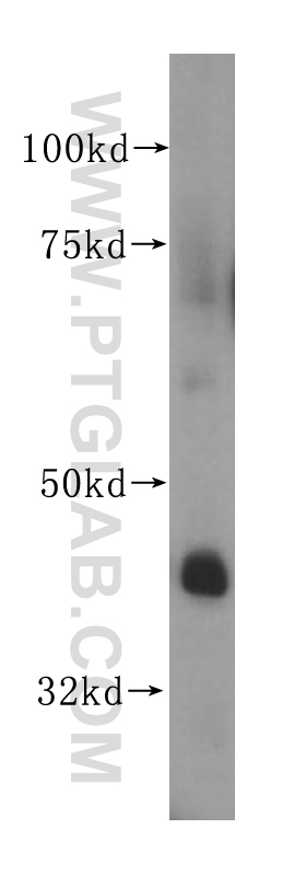 14966-1-AP;human heart tissue