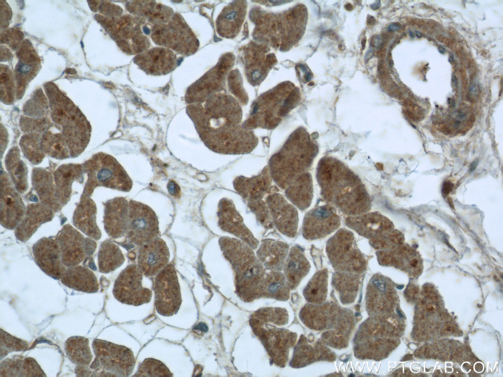 25068-1-AP;human heart tissue