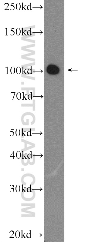 25068-1-AP;A431 cells