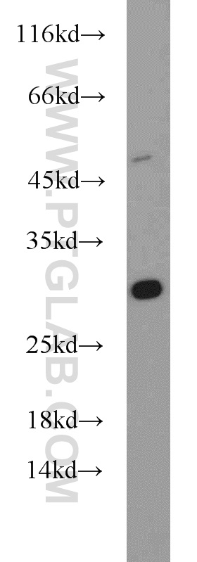 10656-1-AP;A431 cell