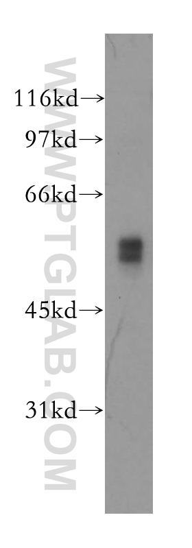 13075-1-AP;mouse lung tissue