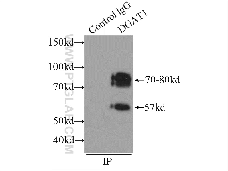 11561-1-AP;mouse heart tissue