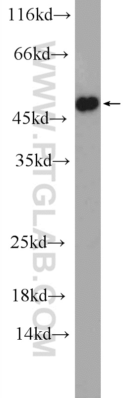 11561-1-AP;mouse heart tissue