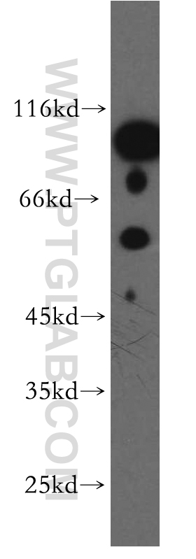 13705-1-AP;HeLa cell