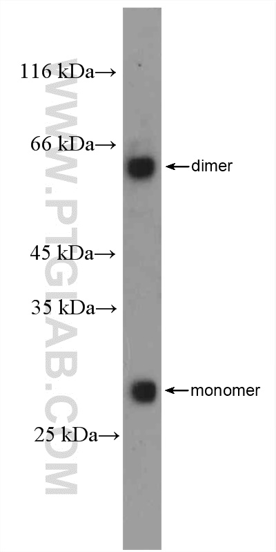 16314-1-AP;mouse kidney tissue