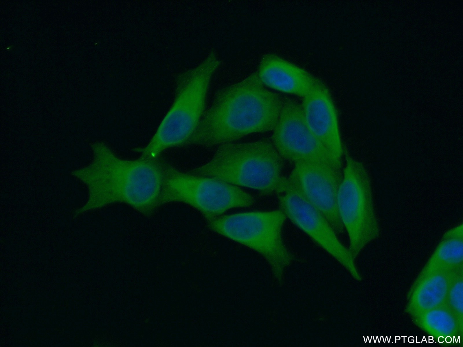 24525-1-AP;HeLa cells