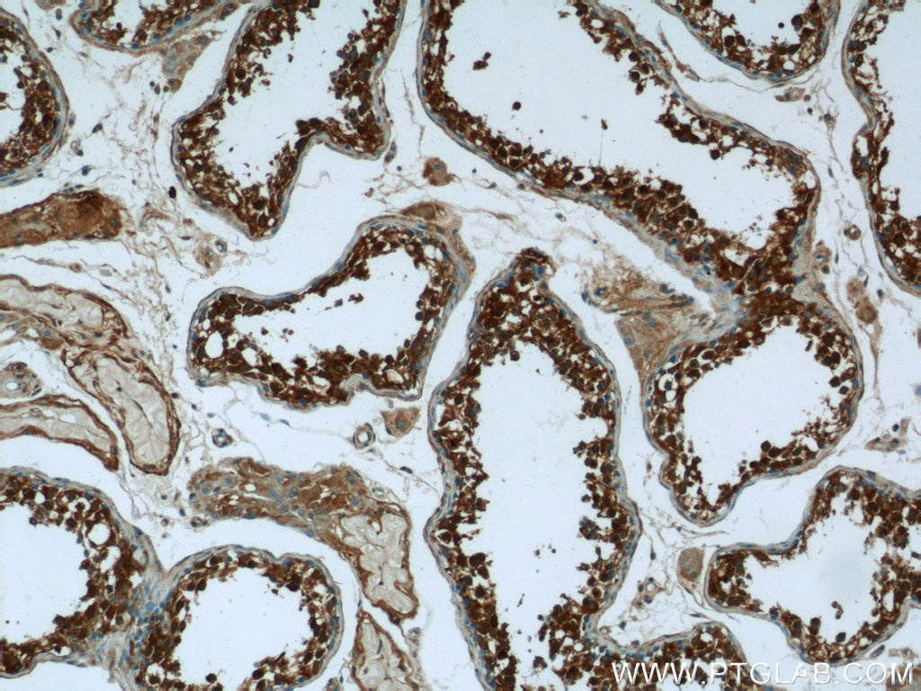 24525-1-AP;human testis tissue