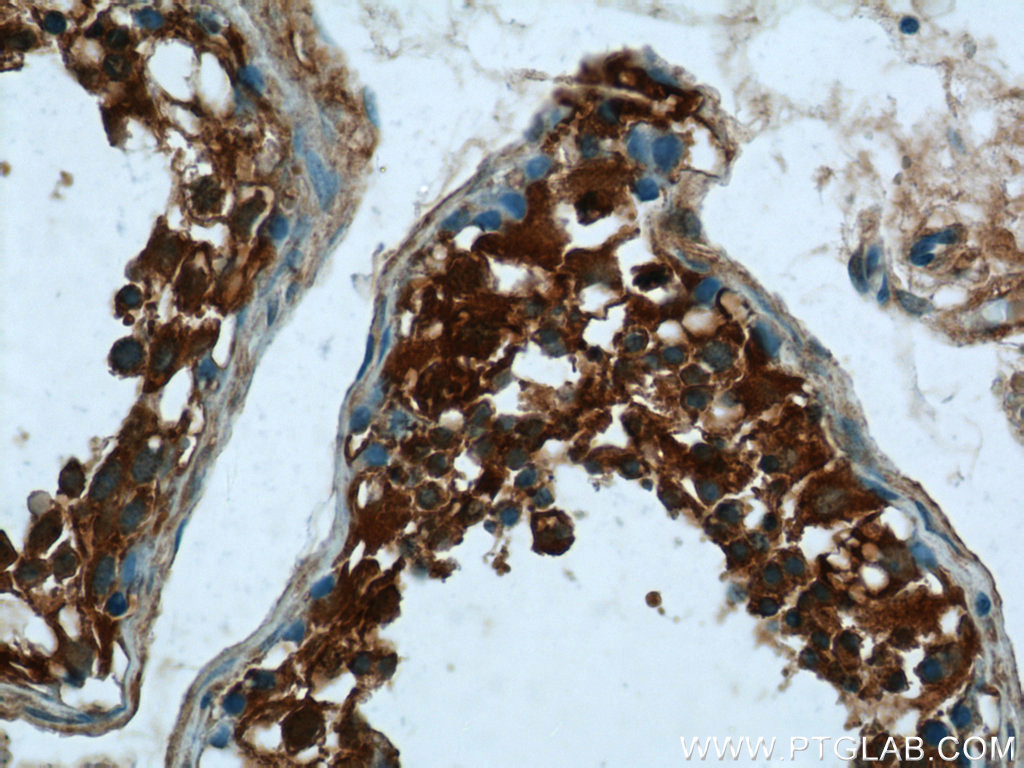 24525-1-AP;human testis tissue