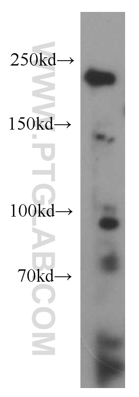 20567-1-AP;K-562 cells