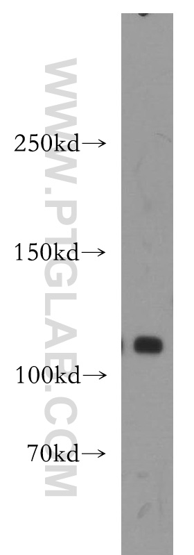 14689-1-AP;HeLa cells