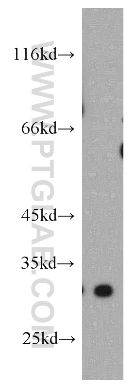 21112-1-AP;human placenta tissue