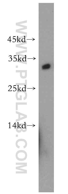 21051-1-AP;mouse skeletal muscle tissue