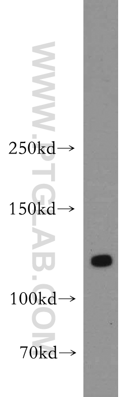 55056-1-AP;human brain tissue