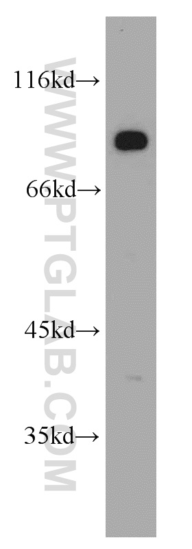 21584-1-AP;mouse brain tissue