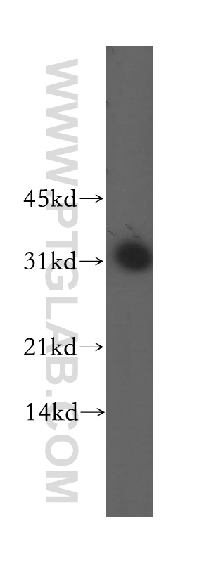 13261-3-AP;mouse lung tissue