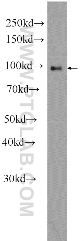 24813-1-AP;mouse liver tissue