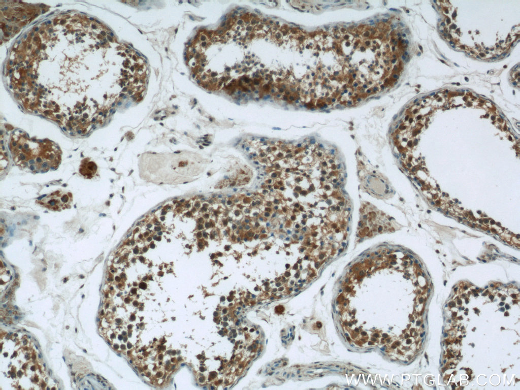 25072-1-AP;human testis tissue