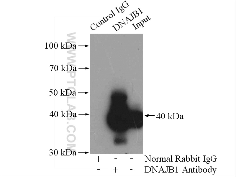 13174-1-AP;mouse lung tissue