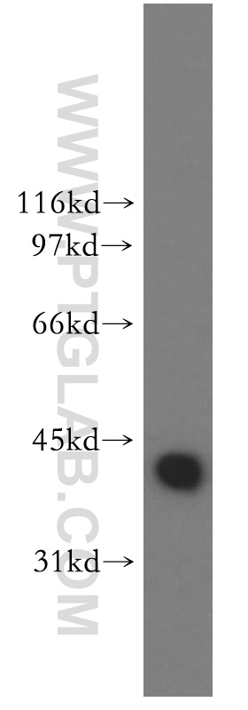 13174-1-AP;mouse spleen tissue