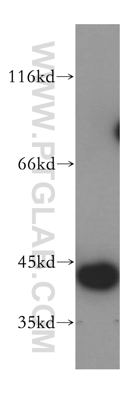 16780-1-AP;mouse uterus tissue