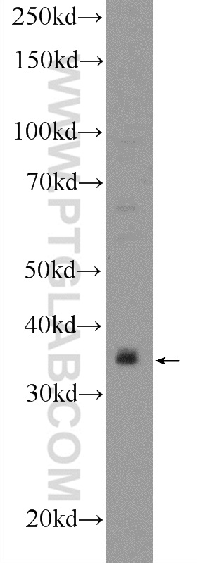 18540-1-AP;RAW 264.7 cells