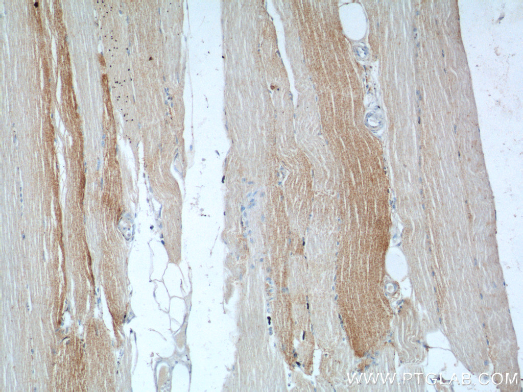 17331-1-AP;human skeletal muscle tissue