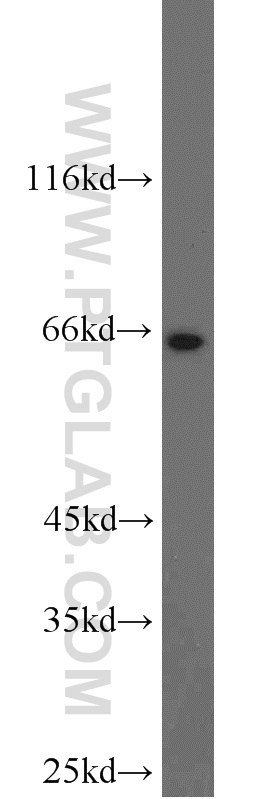 17331-1-AP;HeLa cells