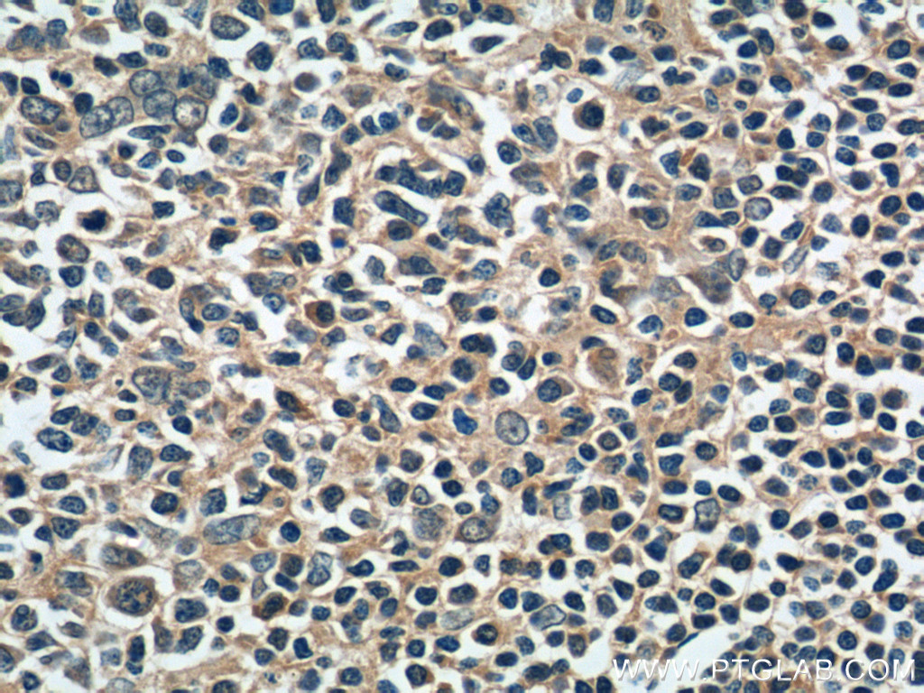 22652-1-AP;human tonsillitis tissue